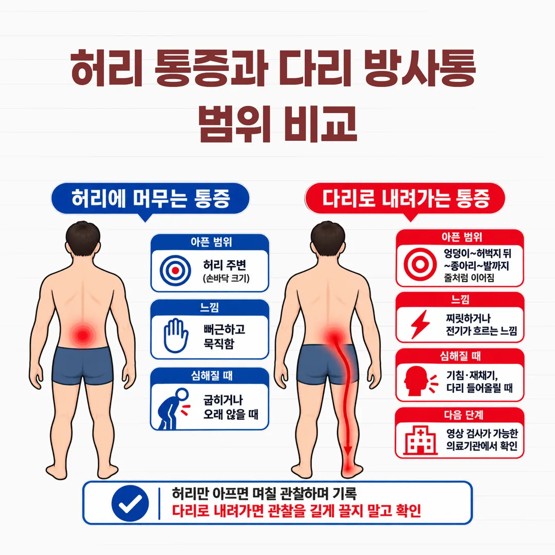 허리에 머무는 통증과 엉덩이에서 종아리로 내려가는 방사통 범위 비교