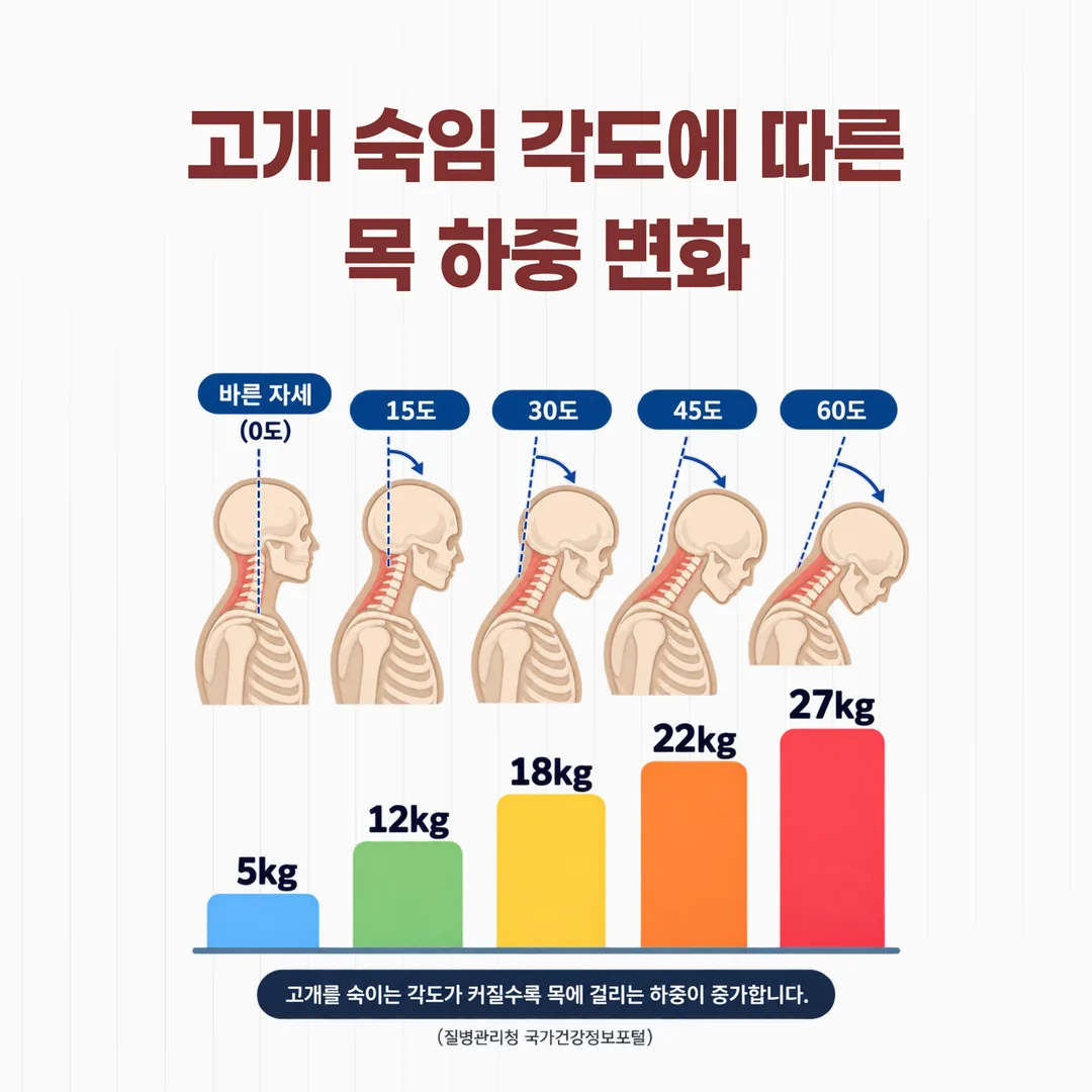 고개 숙임 각도별 목 하중 막대그래프
