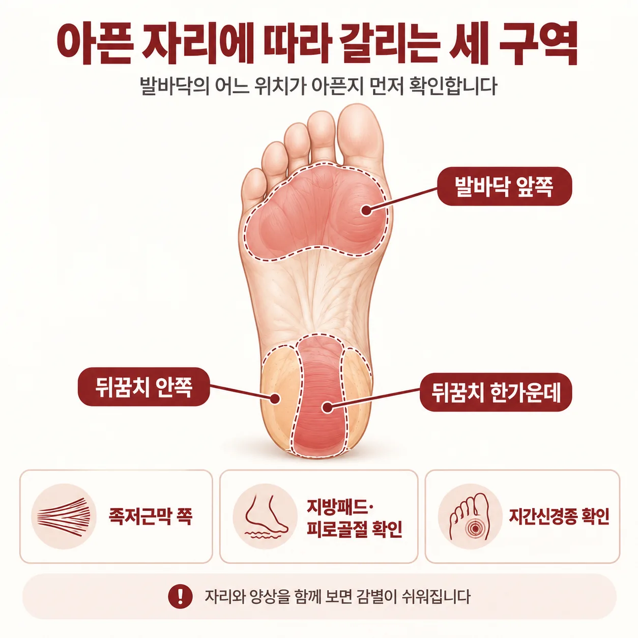 아픈 자리에 따라 갈리는 발바닥 세 구역 감별 도표