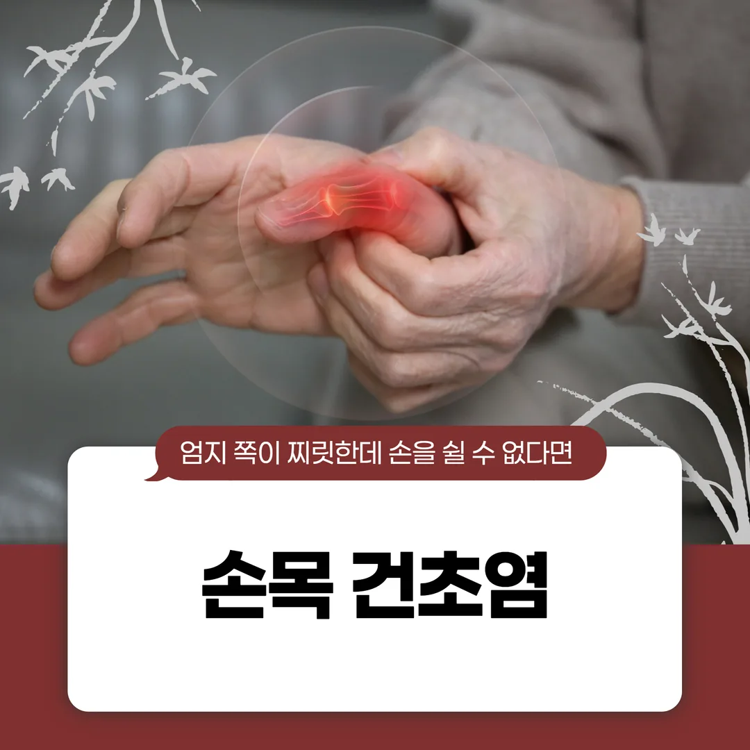 손목 건초염, 엄지 쪽이 찌릿한데 손을 쉴 수 없다면