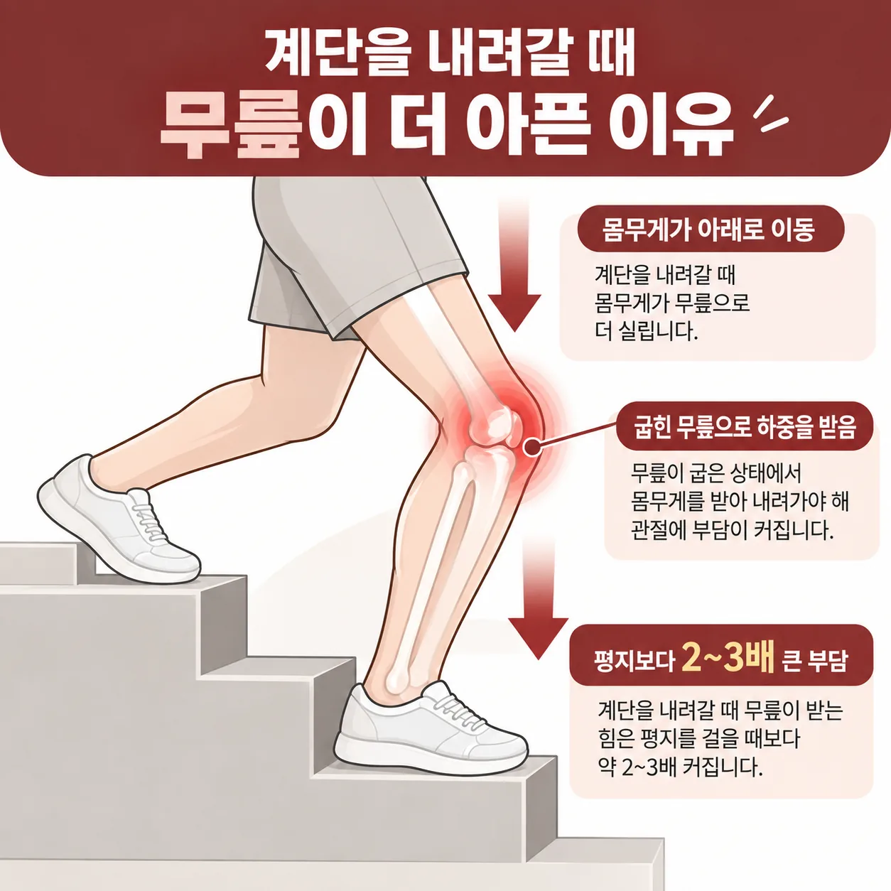 계단 내려갈 때 무릎이 굽은 채 몸무게를 받는 모습 개념도