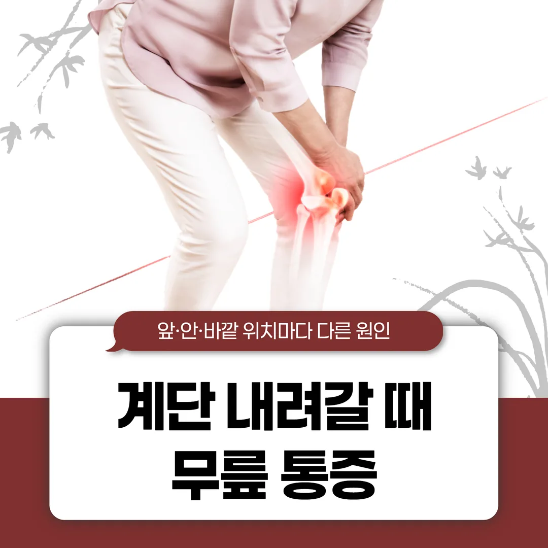 계단 내려갈 때 무릎 통증, 앞·안·바깥 위치마다 다른 원인