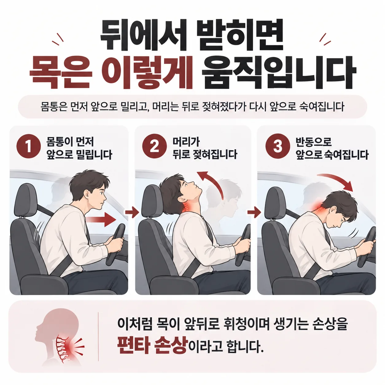 뒤에서 받힌 사고 때 목이 앞뒤로 휘청이는 편타 손상 움직임 순서 도식