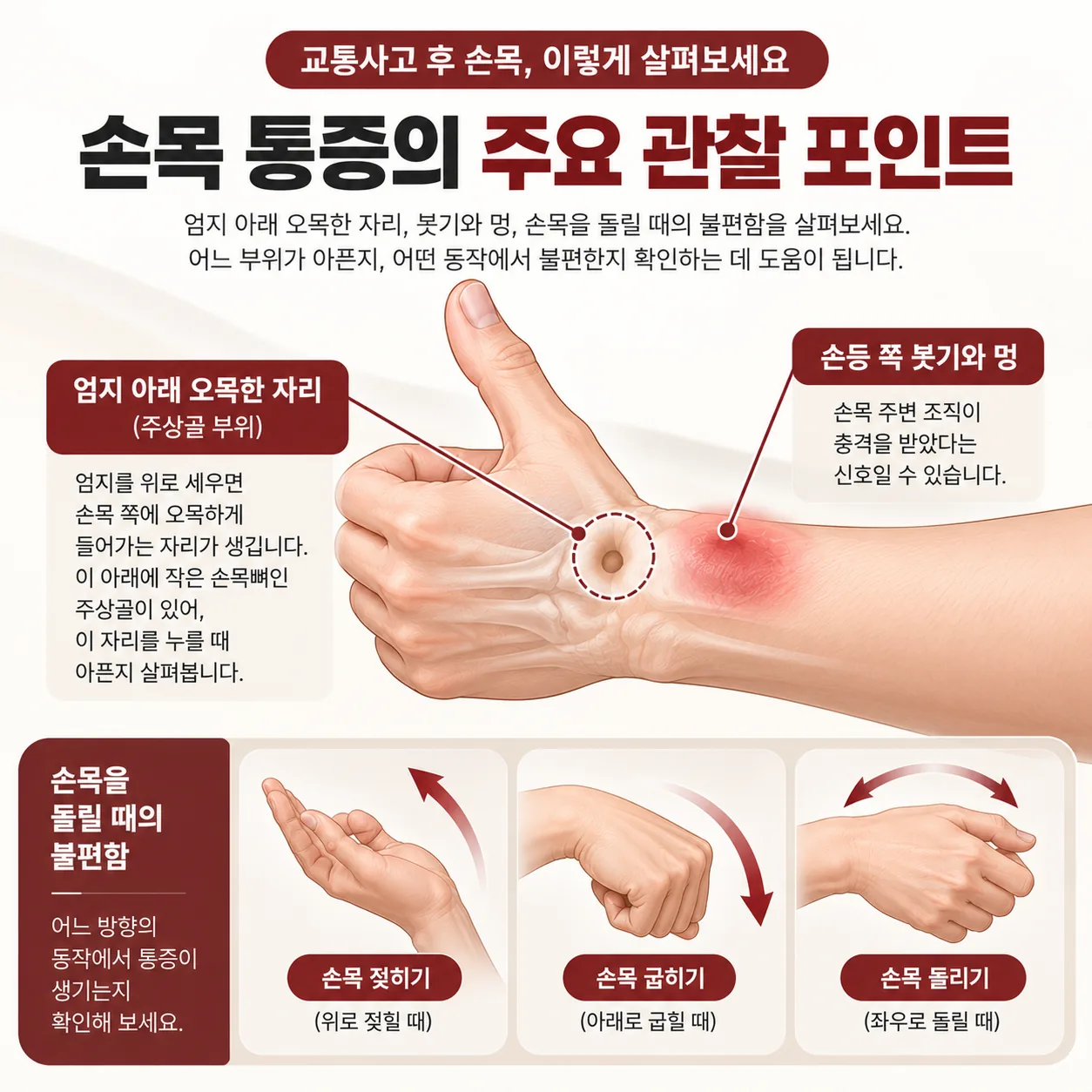 엄지 아래 오목한 손목 자리와 붓기, 손목을 돌리는 방향을 표시한 관찰 도식