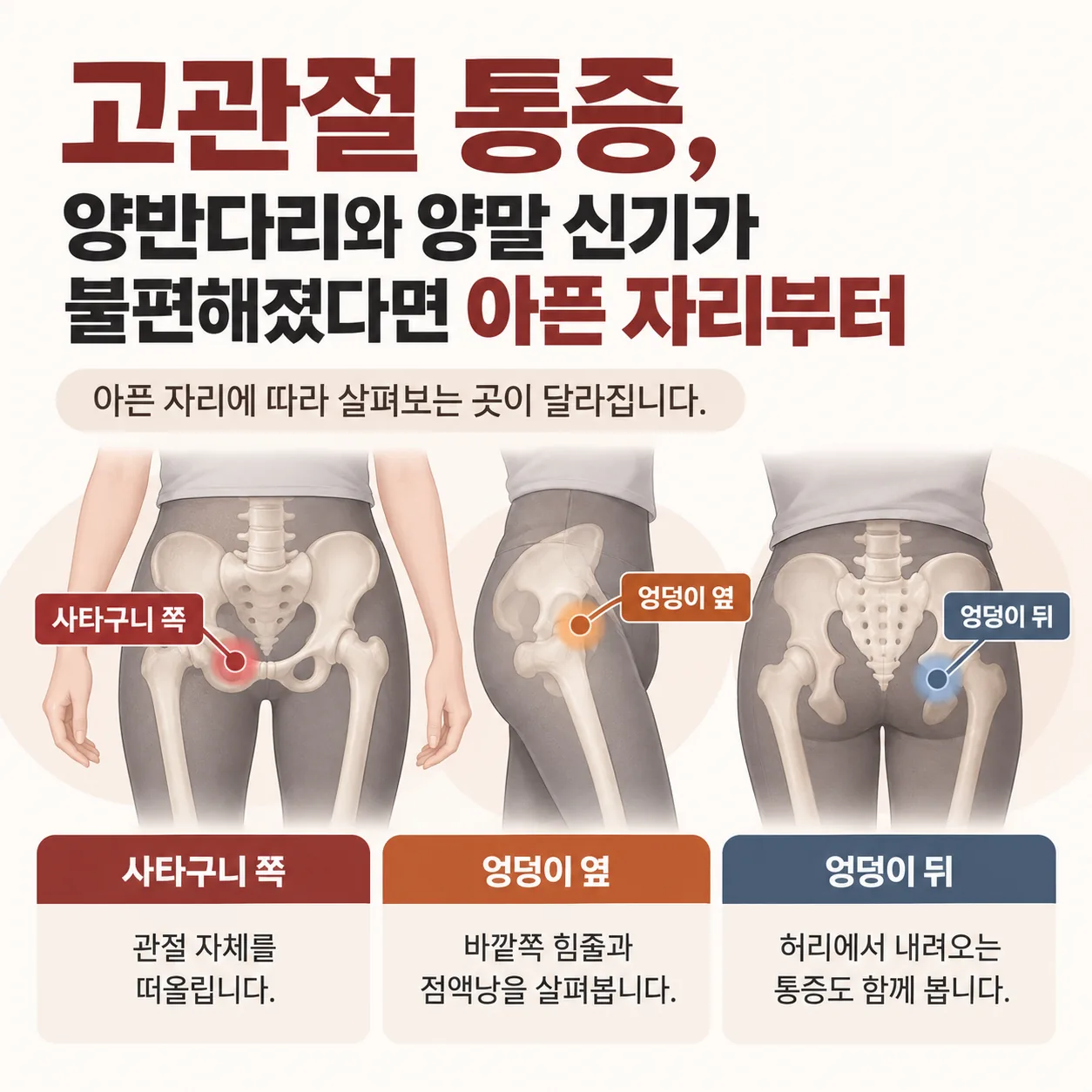고관절 통증이 느껴지는 사타구니 쪽, 엉덩이 옆, 엉덩이 뒤 세 자리를 색으로 표시한 개념도