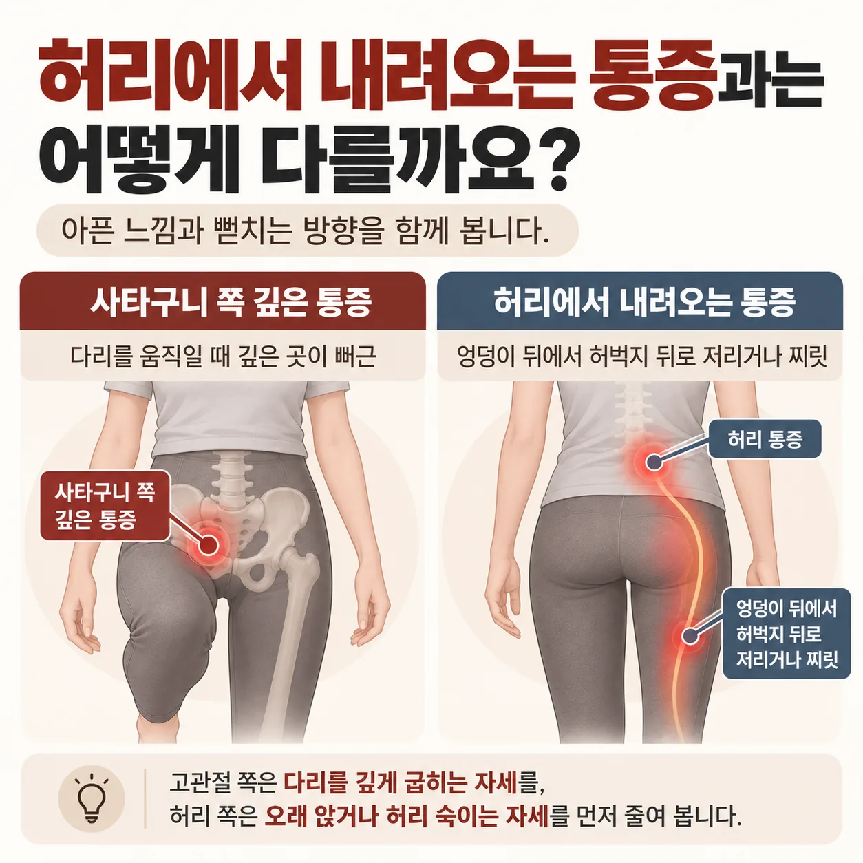 허리에서 엉덩이 뒤와 허벅지 뒤로 내려가는 통증 경로와 사타구니 쪽 관절 통증 자리를 비교한 그림