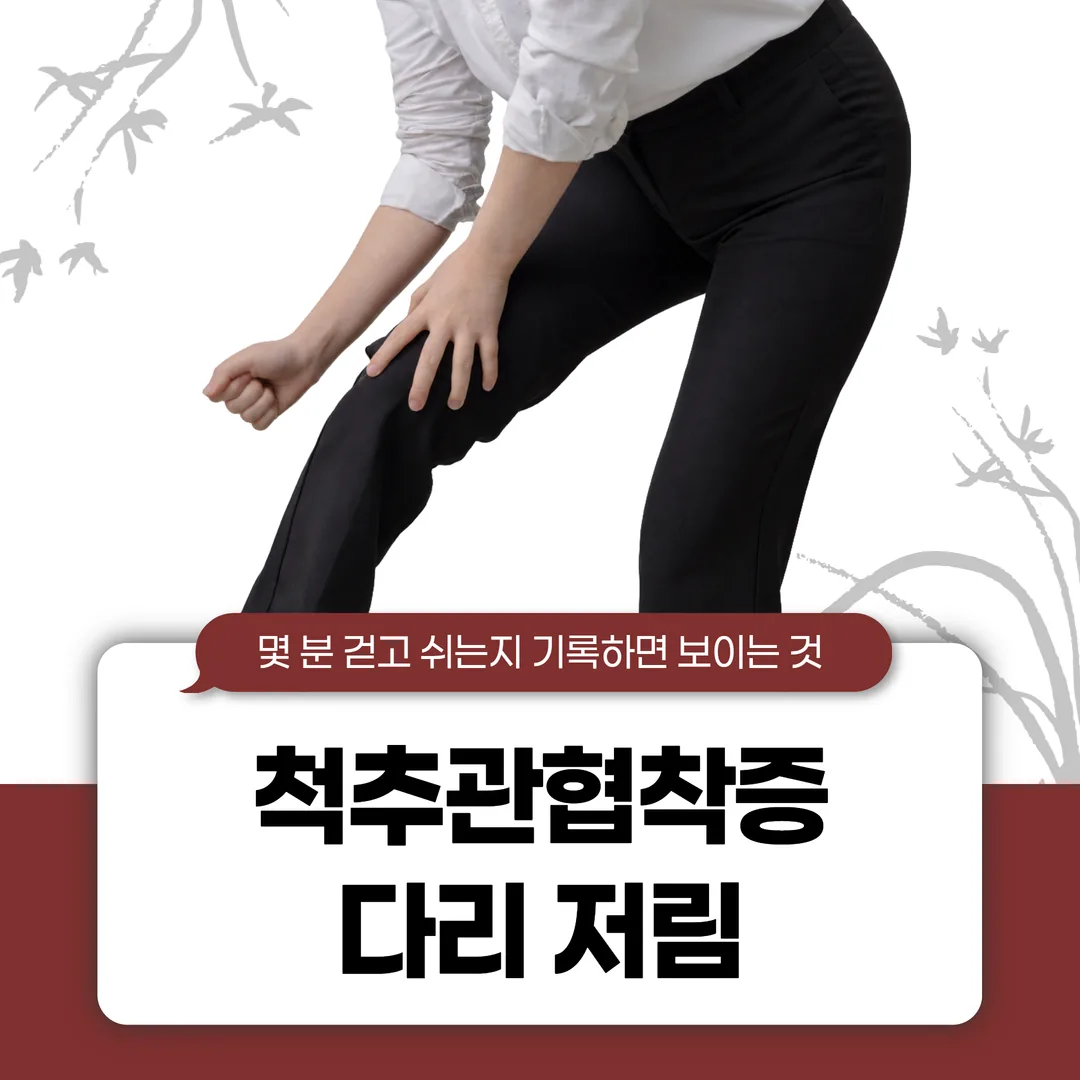 척추관협착증 다리 저림, 몇 분 걷고 쉬는지 기록하면 보이는 것